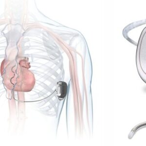 Aurora EV-ICD System